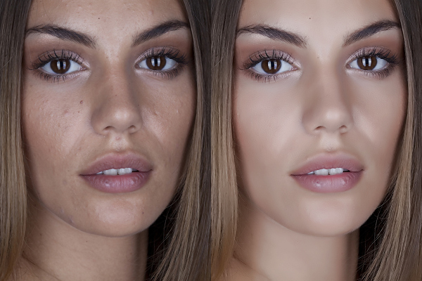 ���ֵĺ��ڿ��ã���������ĥƤ�Ļ���ԭ��